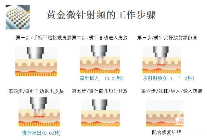 祛黄褐斑的方法*全解答！有黄褐斑困扰的姐妹进来看！