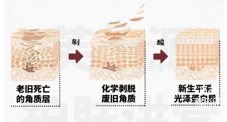 祛黄褐斑的方法*全解答!有黄褐斑困扰的姐妹进来看!