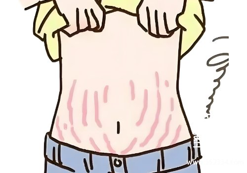 韩悦医生做腹壁整形吗？技术高超、审美在线
