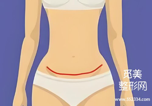 傅秀军腹壁整形怎么样？医生擅长领域及技术特色分析