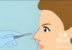 上海九院整形科鼻子价目表！附25年详细价格表