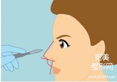 北京协和整形鼻子科价格表！从1000元起！收费、详细信息等一览