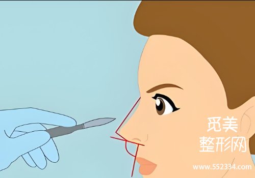 潍坊人民医院整形科鼻子整形怎么样？医院技术很牛