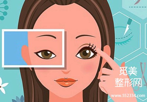 广州博研双眼皮怎么样做?凭借专业的技术以及贴心的服务脱颖而出