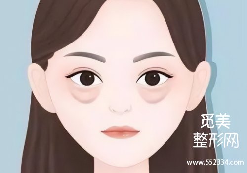 广州李向阳祛眼袋好吗?医生口碑技术点评!戳进来看