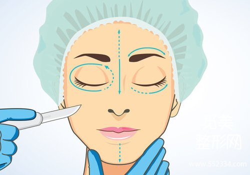 佛山双眼皮修复陈蕾医生好吗？基本信息、坐诊医院等更新